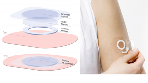 The Viaskin patch features a titanium backing and an adhesive crown